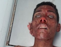 Atenção Imagens Fortes: Três morrem e um fica ferido em confronto com a PM em São Gonçalo do Amarante