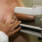 mamografia_1479030
