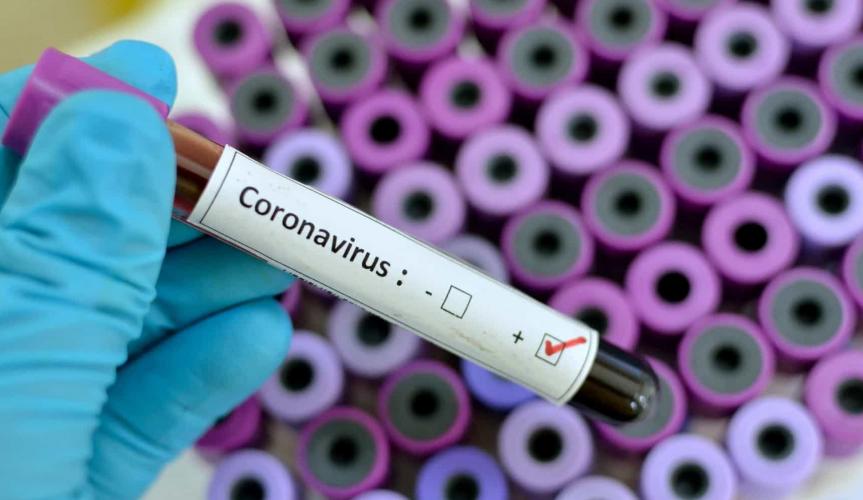 virus