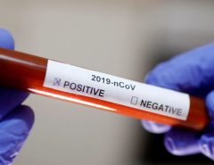 CHEGOU CHEGANDO: EUA registram mais de 3 mil mortes e 220 mil novos casos de coronavirus em 24 h