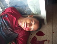 Macaíba: Homem reage a assalto e mata bandido (Atenção! Imagens Fortes)