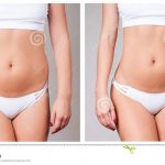 Cirurgia plastica
