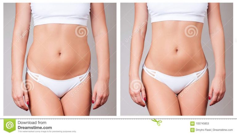 Cirurgia plastica