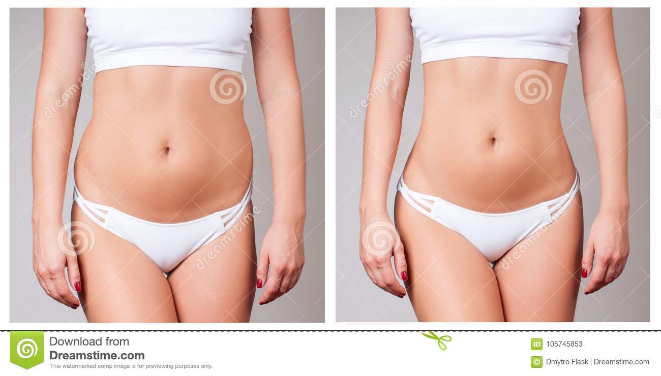 Cirurgia plastica