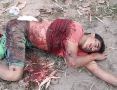 Atenção Imagens Fortes: Mesmo baleado Sargento Heronides conseguiu balear os dois bandidos