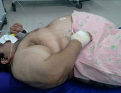 DESCASO: Homem com quase 300 quilos aguarda transferência para UTI em colchão no chão de hospital
