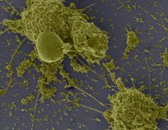 Testes podem confirmar nova variante do coronavirus que é mais transmissível