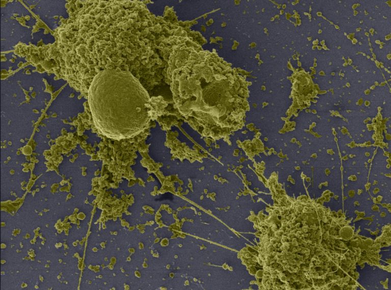 corona virus