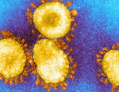 CORONAVIRUS: Variante do coronavírus: Por que o Japão descobriu antes do Brasil a linhagem do vírus vinda de Manaus