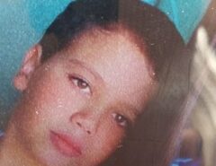 TRAGÉDIA Menino de 10 anos morre após cirurgia para extrair dente