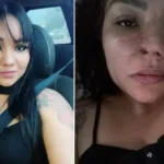 mulher-perdeu-parte-nariz-cirurgia-1