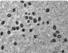 RN registra três novos casos de Mpox; pacientes estão em isolamento domiciliar